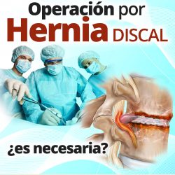 Operación por Hernia Discal ¿es necesaria?