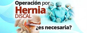 Operación por Hernia Discal ¿es necesaria?